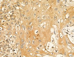 LARS2 Polyclonal Antibody:Antibodies, Polyclonal