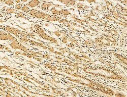 LARS2 Polyclonal Antibody:Antibodies, Polyclonal