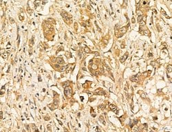 LARS2 Polyclonal Antibody:Antibodies, Polyclonal