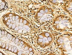 LARS2 Polyclonal Antibody:Antibodies, Polyclonal