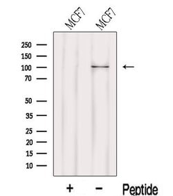 LARS2 Polyclonal Antibody:Antibodies, Polyclonal
