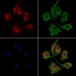 Invitrogen Lass2 Polyclonal Antibody 100 &mu;L; Unconjugated:Antibodies,