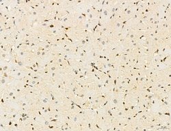 Invitrogen Lass2 Polyclonal Antibody 100 &mu;L; Unconjugated:Antibodies,