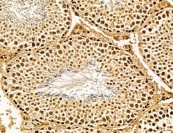 Invitrogen Lass2 Polyclonal Antibody 100 &mu;L; Unconjugated:Antibodies,