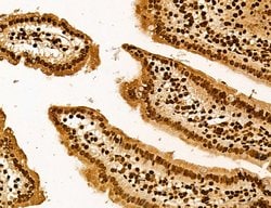 Invitrogen Lass2 Polyclonal Antibody 100 &mu;L; Unconjugated:Antibodies,