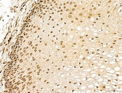 Invitrogen Lass2 Polyclonal Antibody 100 &mu;L; Unconjugated:Antibodies,