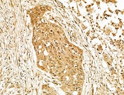 Invitrogen Lass2 Polyclonal Antibody 100 &mu;L; Unconjugated:Antibodies,
