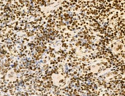 Invitrogen Lass2 Polyclonal Antibody 100 &mu;L; Unconjugated:Antibodies,