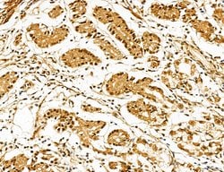 Invitrogen Lass2 Polyclonal Antibody 100 &mu;L; Unconjugated:Antibodies,
