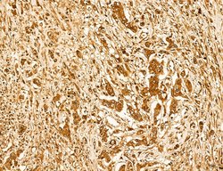 Invitrogen Lass2 Polyclonal Antibody 100 &mu;L; Unconjugated:Antibodies,
