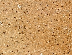 Invitrogen Lass2 Polyclonal Antibody 100 &mu;L; Unconjugated:Antibodies,