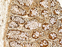 Invitrogen Lass2 Polyclonal Antibody 100 &mu;L; Unconjugated:Antibodies,