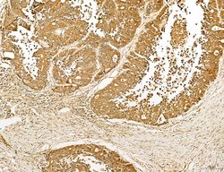Invitrogen Lass2 Polyclonal Antibody 100 &mu;L; Unconjugated:Antibodies,