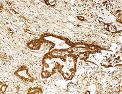 Invitrogen Lass2 Polyclonal Antibody 100 &mu;L; Unconjugated:Antibodies,