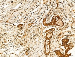 Invitrogen Lass2 Polyclonal Antibody 100 &mu;L; Unconjugated:Antibodies,