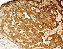 Invitrogen Lass2 Polyclonal Antibody 100 &mu;L; Unconjugated:Antibodies,