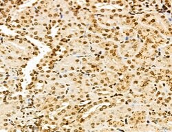 Invitrogen Lass2 Polyclonal Antibody 100 &mu;L; Unconjugated:Antibodies,