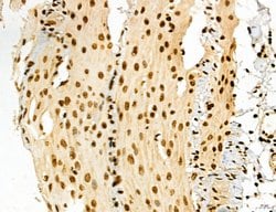 Invitrogen Lass2 Polyclonal Antibody 100 &mu;L; Unconjugated:Antibodies,