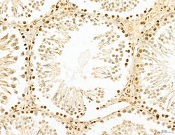 Invitrogen Lass2 Polyclonal Antibody 100 &mu;L; Unconjugated:Antibodies,
