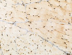 Invitrogen Lass2 Polyclonal Antibody 100 &mu;L; Unconjugated:Antibodies,
