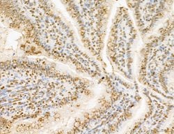 Invitrogen Lass2 Polyclonal Antibody 100 &mu;L; Unconjugated:Antibodies,