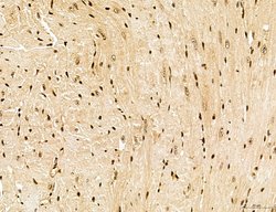 Invitrogen Lass2 Polyclonal Antibody 100 &mu;L; Unconjugated:Antibodies,