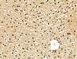Invitrogen Lass2 Polyclonal Antibody 100 &mu;L; Unconjugated:Antibodies,