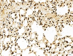 Invitrogen Lass2 Polyclonal Antibody 100 &mu;L; Unconjugated:Antibodies,
