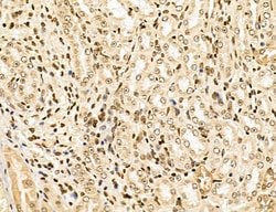 Invitrogen Lass2 Polyclonal Antibody 100 &mu;L; Unconjugated:Antibodies,