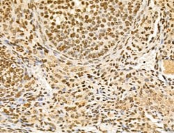Invitrogen Lass2 Polyclonal Antibody 100 &mu;L; Unconjugated:Antibodies,