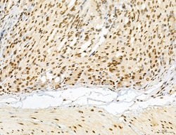 Invitrogen Lass2 Polyclonal Antibody 100 &mu;L; Unconjugated:Antibodies,