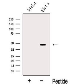 Invitrogen Lass2 Polyclonal Antibody 100 &mu;L; Unconjugated:Antibodies,