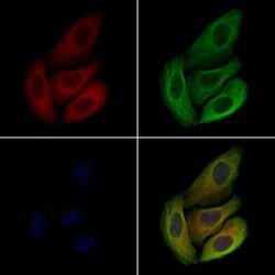 Invitrogen LAT Polyclonal Antibody 100 &mu;L; Unconjugated:Antibodies,