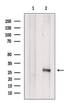 Invitrogen LAT Polyclonal Antibody 100 &mu;L; Unconjugated:Antibodies,