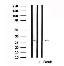 Invitrogen LAT Polyclonal Antibody 100 &mu;L; Unconjugated:Antibodies,