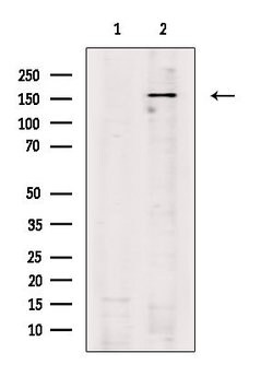 Invitrogen LATS1/LATS2 Polyclonal Antibody 100 &mu;L; Unconjugated:Antibodies,