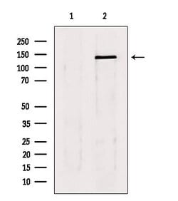 Invitrogen LATS1/LATS2 Polyclonal Antibody 100 &mu;L; Unconjugated:Antibodies,