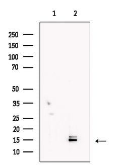 Invitrogen LC3A/LC3B Polyclonal Antibody 100 &mu;L; Unconjugated:Antibodies,