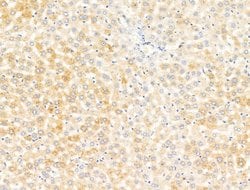 Invitrogen Lefty Polyclonal Antibody 100 &mu;L | Buy Online | Invitrogen&trade; | Fisher Scientific