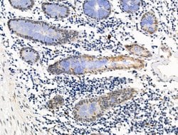Invitrogen Galectin 7 Polyclonal Antibody 100 &mu;L; Unconjugated:Antibodies,