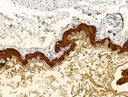 Invitrogen Galectin 7 Polyclonal Antibody 100 &mu;L; Unconjugated:Antibodies,