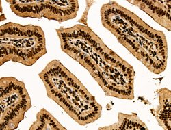 Invitrogen Galectin 7 Polyclonal Antibody 100 &mu;L; Unconjugated:Antibodies,