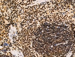 Invitrogen Galectin 7 Polyclonal Antibody 100 &mu;L; Unconjugated:Antibodies,