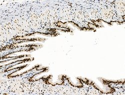 Invitrogen Galectin 7 Polyclonal Antibody 100 &mu;L; Unconjugated:Antibodies,