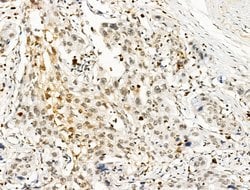Invitrogen Galectin 7 Polyclonal Antibody 100 &mu;L; Unconjugated:Antibodies,