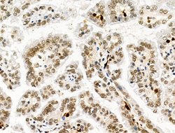 Invitrogen Galectin 7 Polyclonal Antibody 100 &mu;L; Unconjugated:Antibodies,