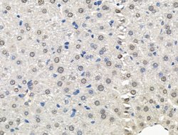 Invitrogen Galectin 7 Polyclonal Antibody 100 &mu;L; Unconjugated:Antibodies,