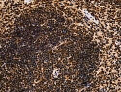 Invitrogen Galectin 7 Polyclonal Antibody 100 &mu;L; Unconjugated:Antibodies,