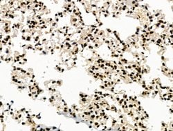 Invitrogen Galectin 7 Polyclonal Antibody 100 &mu;L; Unconjugated:Antibodies,
