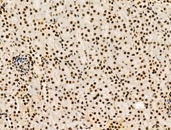 Invitrogen Galectin 7 Polyclonal Antibody 100 &mu;L; Unconjugated:Antibodies,